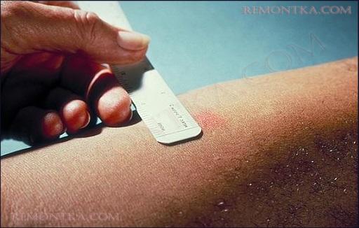 Кварцевый резонатор