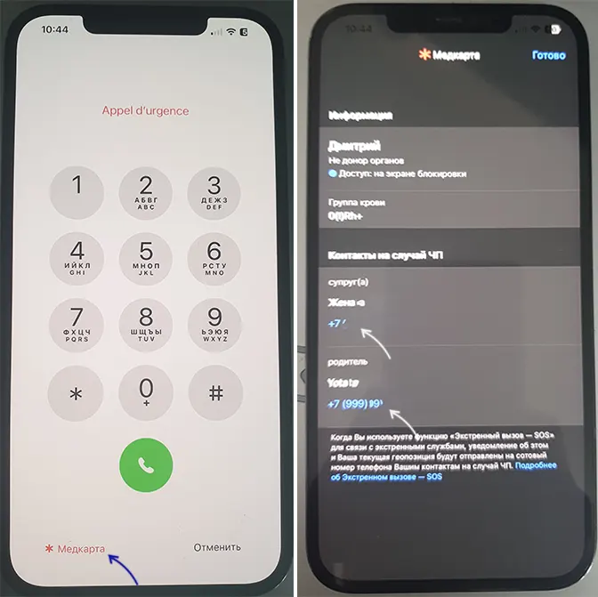 Доступ к контактам на случай ЧП на заблокированном iPhone